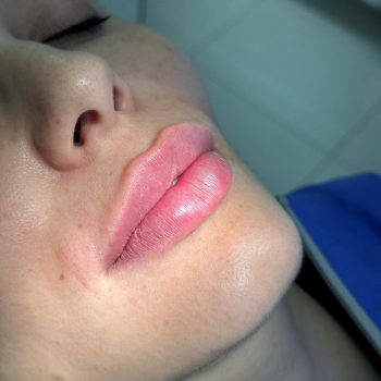 44d8a72f-b2e9-44f3-b0dd-abb5f4c0f3b5